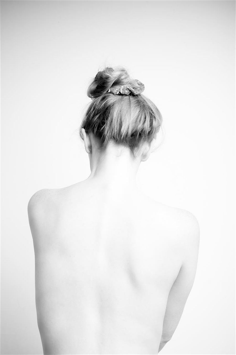 Komplet guide til behandling af rygsmerter